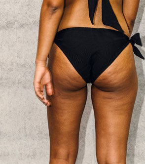 Bikini Slip Knotted HALESIA Biobased Structure